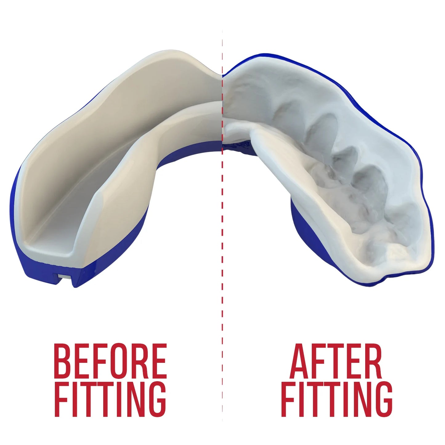 SAFEJAWZ Extro Series Shark Self Fit Mouthguards - Blue
